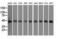 Death Associated Protein Kinase 2 antibody, NBP2-02477, Novus Biologicals, Western Blot image 