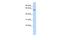 Zinc Finger Protein 165 antibody, A12869, Boster Biological Technology, Western Blot image 