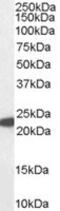 Glutathione Peroxidase 1 antibody, MBS421332, MyBioSource, Western Blot image 