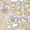 Ketohexokinase antibody, A7440, ABclonal Technology, Immunohistochemistry paraffin image 