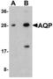 Aquaporin 2 antibody, LS-C201172, Lifespan Biosciences, Western Blot image 