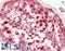 NDC80 Kinetochore Complex Component antibody, LS-B13324, Lifespan Biosciences, Immunohistochemistry paraffin image 