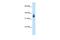 MAGE Family Member A8 antibody, PA5-42130, Invitrogen Antibodies, Western Blot image 