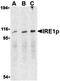 Endoplasmic Reticulum To Nucleus Signaling 1 antibody, orb74675, Biorbyt, Western Blot image 