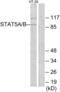 Signal Transducer And Activator Of Transcription 5A antibody, abx014064, Abbexa, Western Blot image 