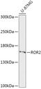 Tyrosine-protein kinase transmembrane receptor ROR2 antibody, GTX33470, GeneTex, Western Blot image 