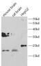Growth Factor, Augmenter Of Liver Regeneration antibody, FNab00349, FineTest, Western Blot image 