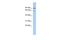 Zinc Finger Protein 791 antibody, A16973, Boster Biological Technology, Western Blot image 