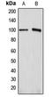 ATPase Na+/K+ Transporting Subunit Alpha 1 antibody, LS-B13592, Lifespan Biosciences, Western Blot image 