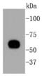 Keratin 10 antibody, A02305-2, Boster Biological Technology, Western Blot image 