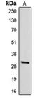 Iodothyronine Deiodinase 3 antibody, orb213851, Biorbyt, Western Blot image 