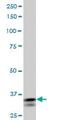 Short Stature Homeobox 2 antibody, ab55740, Abcam, Western Blot image 