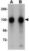 Family With Sequence Similarity 120A antibody, GTX31385, GeneTex, Western Blot image 