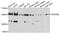 RNA Polymerase II Subunit B antibody, STJ27724, St John