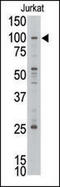 MLLT10 Histone Lysine Methyltransferase DOT1L Cofactor antibody, 62-161, ProSci, Western Blot image 