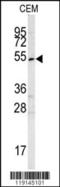 SET And MYND Domain Containing 3 antibody, 62-842, ProSci, Western Blot image 