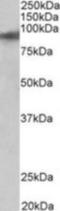 Zinc Finger Protein 652 antibody, NBP1-97753, Novus Biologicals, Western Blot image 