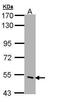 Cholinergic Receptor Nicotinic Delta Subunit antibody, PA5-28829, Invitrogen Antibodies, Western Blot image 