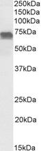 E2F Transcription Factor 4 antibody, 43-405, ProSci, Enzyme Linked Immunosorbent Assay image 