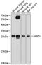 Suppressor Of Cytokine Signaling 1 antibody, 13-289, ProSci, Western Blot image 