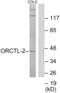 Solute Carrier Family 22 Member 18 antibody, abx013753, Abbexa, Western Blot image 