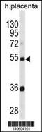 Tektin 3 antibody, 60-560, ProSci, Western Blot image 