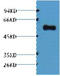 Alliinase antibody, STJ97100, St John