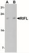 Hepatocellular carcinoma-associated protein TD26 homolog antibody, NBP2-41247, Novus Biologicals, Western Blot image 