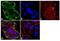Keratin 14 antibody, MA5-11599, Invitrogen Antibodies, Immunofluorescence image 