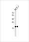 NME/NM23 Nucleoside Diphosphate Kinase 1 antibody, LS-C203940, Lifespan Biosciences, Western Blot image 