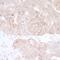 Carbamoyl-Phosphate Synthetase 2, Aspartate Transcarbamylase, And Dihydroorotase antibody, A301-374A, Bethyl Labs, Immunohistochemistry paraffin image 