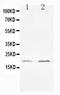 BCL2 Like 1 antibody, PA1232, Boster Biological Technology, Western Blot image 