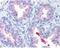 ATP Binding Cassette Subfamily A Member 1 antibody, PA1-32129, Invitrogen Antibodies, Immunohistochemistry paraffin image 