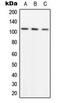 ADAM Metallopeptidase With Thrombospondin Type 1 Motif 1 antibody, LS-C354141, Lifespan Biosciences, Western Blot image 