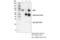 Component Of Inhibitor Of Nuclear Factor Kappa B Kinase Complex antibody, 61294S, Cell Signaling Technology, Immunoprecipitation image 