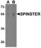 Sphingolipid Transporter 1 (Putative) antibody, A09902, Boster Biological Technology, Western Blot image 