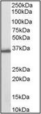 Aldo-Keto Reductase Family 1 Member C3 antibody, orb88110, Biorbyt, Western Blot image 