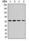Protein Phosphatase 3 Catalytic Subunit Alpha antibody, orb381977, Biorbyt, Western Blot image 