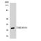 Transmembrane Protein 101 antibody, LS-C200791, Lifespan Biosciences, Western Blot image 