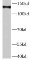 DExH-Box Helicase 9 antibody, FNab02383, FineTest, Western Blot image 