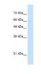 Leucine Zipper And EF-Hand Containing Transmembrane Protein 1 antibody, NBP1-59611, Novus Biologicals, Western Blot image 