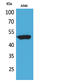 Forkhead Box A1 antibody, STJ96689, St John