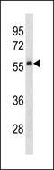 Plasminogen Activator, Urokinase antibody, PA5-49297, Invitrogen Antibodies, Western Blot image 