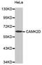 Calcium/Calmodulin Dependent Protein Kinase II Delta antibody, MBS125250, MyBioSource, Western Blot image 