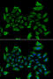 5-aminolevulinate synthase, nonspecific, mitochondrial antibody, STJ28604, St John