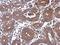 Protein Phosphatase, Mg2+/Mn2+ Dependent 1J antibody, LS-C155212, Lifespan Biosciences, Immunohistochemistry paraffin image 