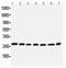 Eukaryotic Translation Initiation Factor 6 antibody, LS-C313157, Lifespan Biosciences, Western Blot image 