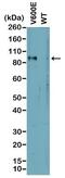 B-Raf Proto-Oncogene, Serine/Threonine Kinase antibody, NBP2-61503, Novus Biologicals, Western Blot image 
