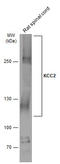 Solute Carrier Family 12 Member 5 antibody, GTX133130, GeneTex, Western Blot image 