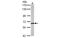 Chaperonin Containing TCP1 Subunit 8 antibody, MBS835302, MyBioSource, Western Blot image 